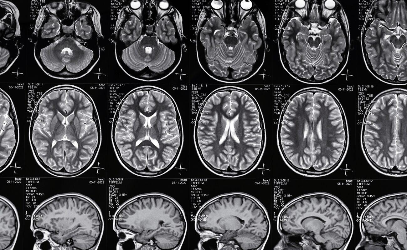 terminologia padronizada em radiologia