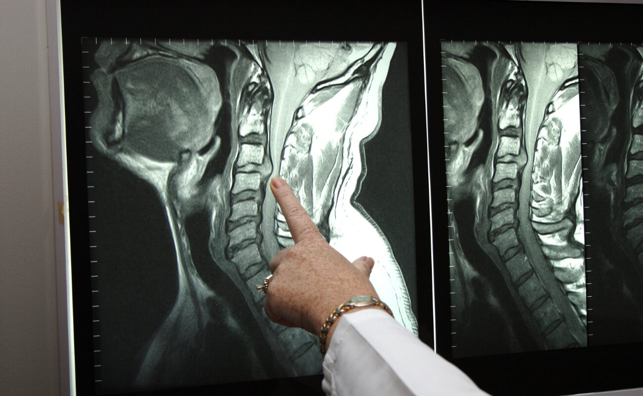 sistema intuitivo em radiologia
