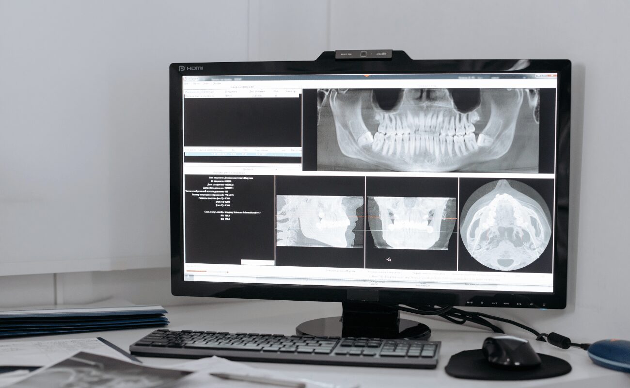 sistemas de radiologia