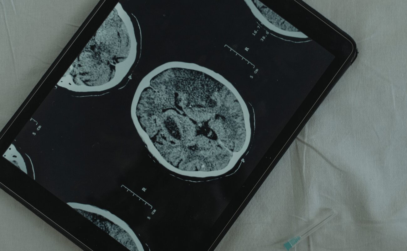 radiologia digital radiologia digital