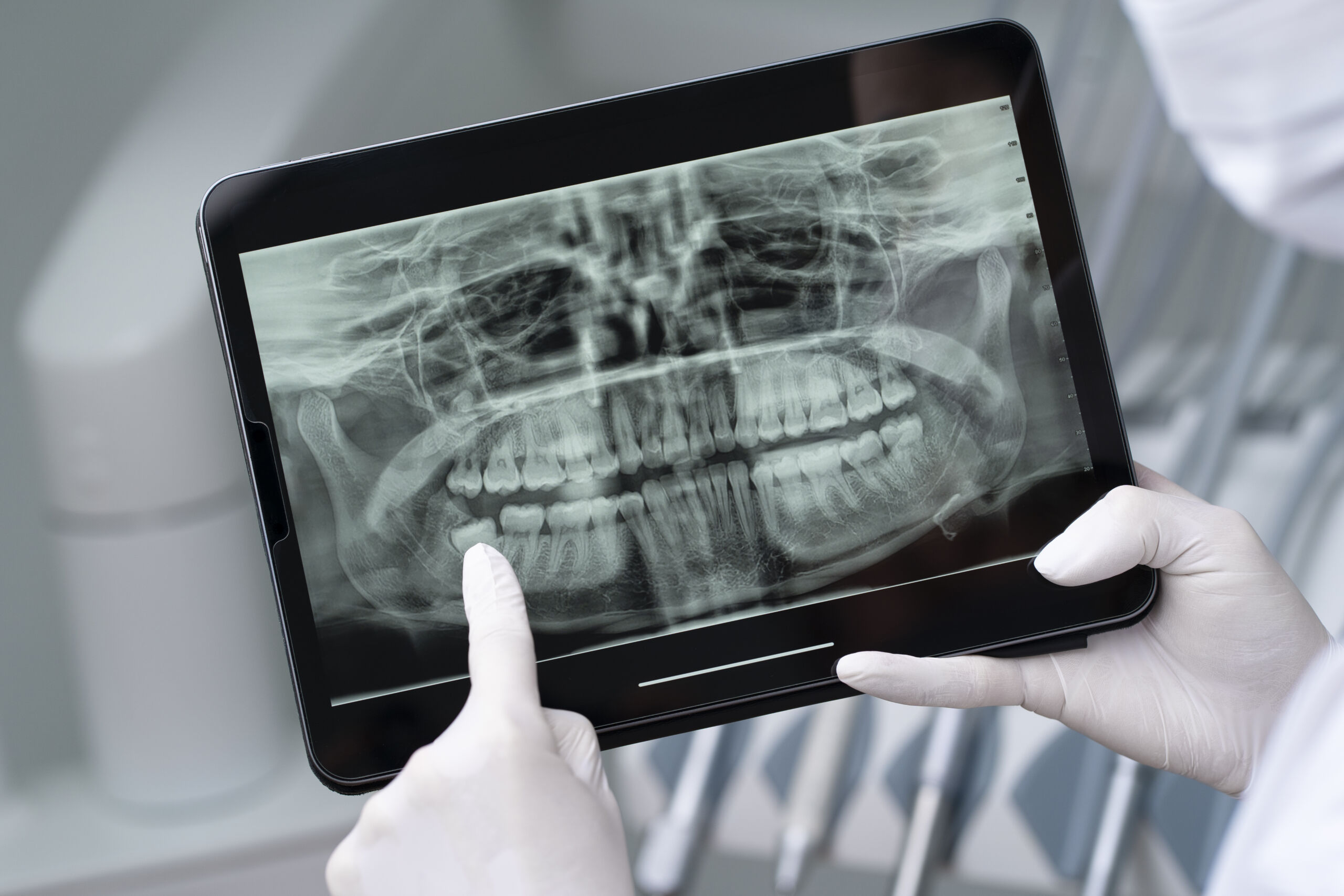 DICOM Print Server